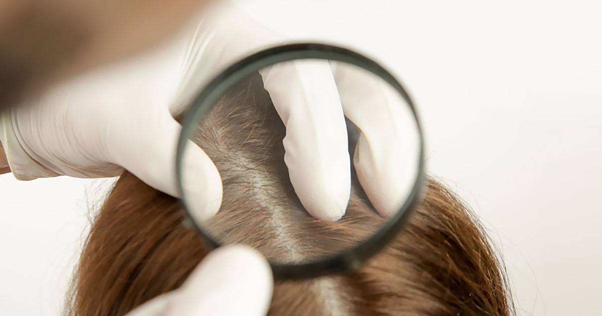 Wie viele Haare