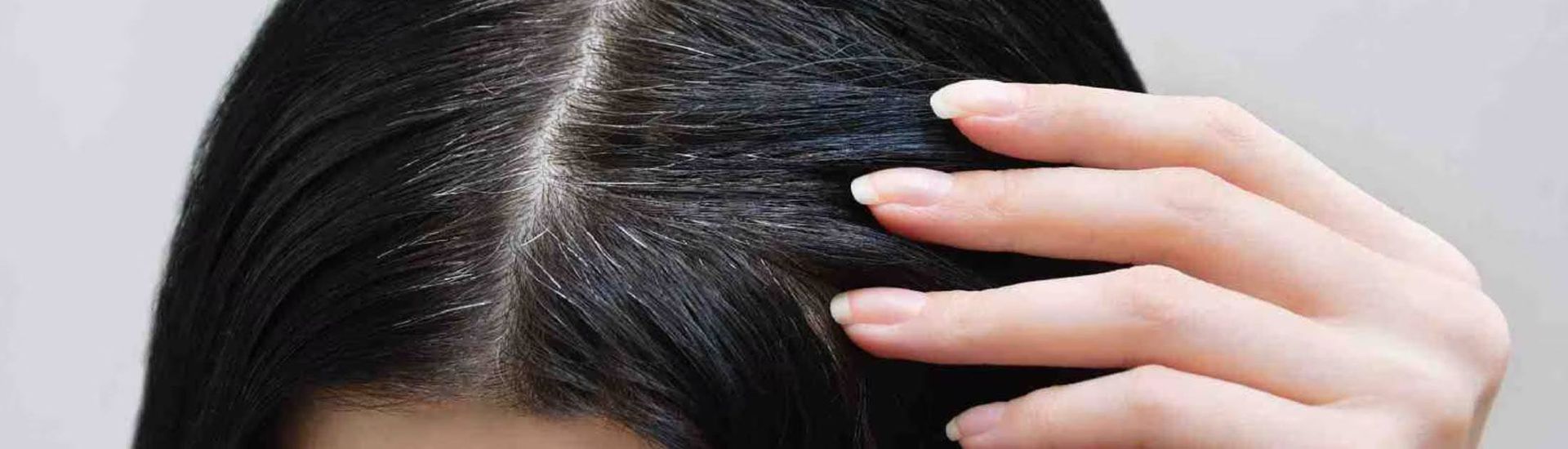 Severe Hair Loss In Women Causes And Solutions